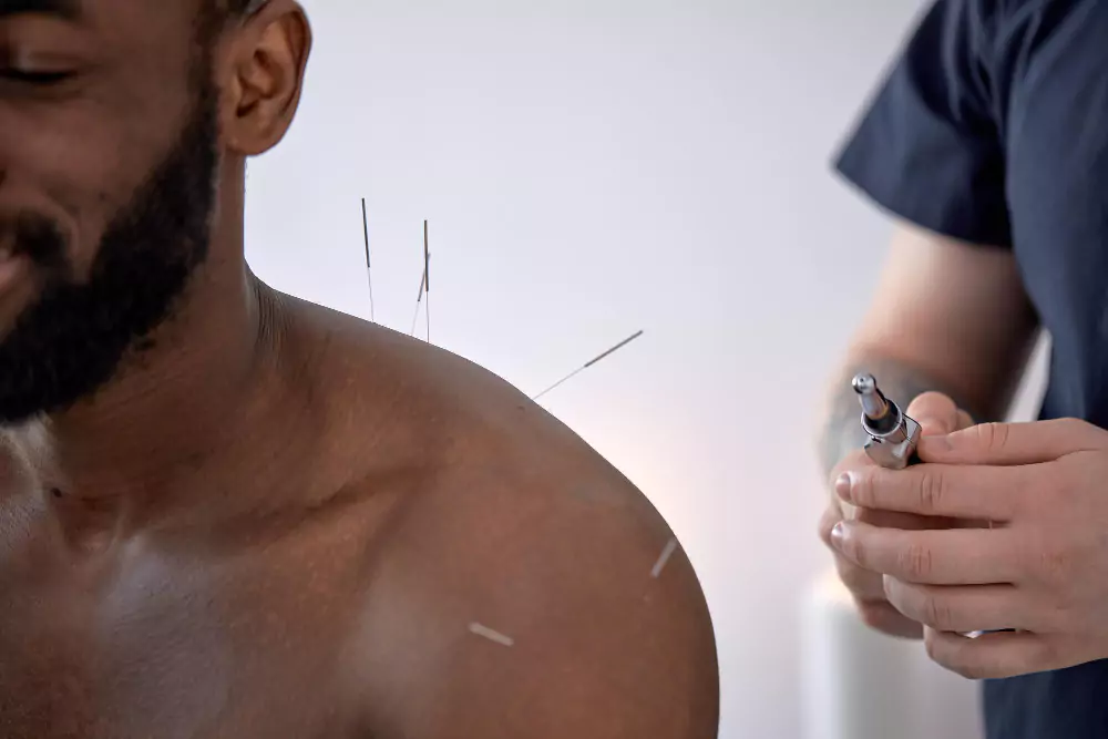Dry Needling